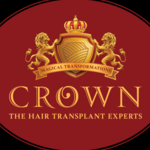 Crownhair Transplant